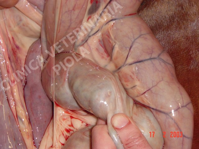 Banda mesodiverticolare